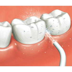 Escovas de dentes elétricas